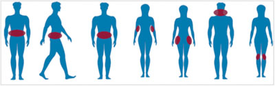 lipocontrast-zones